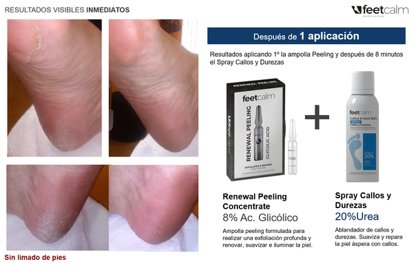Exfolia, suaviza y repara piel con callos