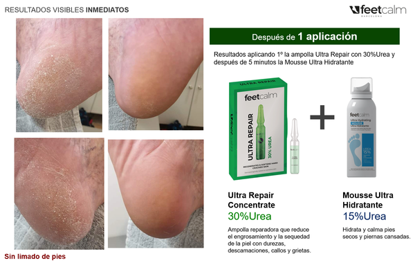 Repara e hidrata piel extremadamente seca
